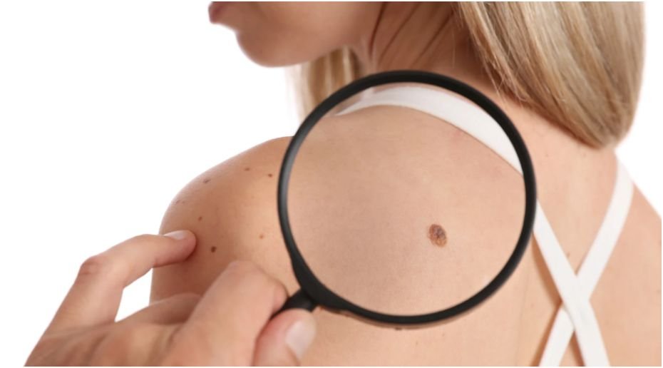 Comprehensive Skin Check Services in Melbourne