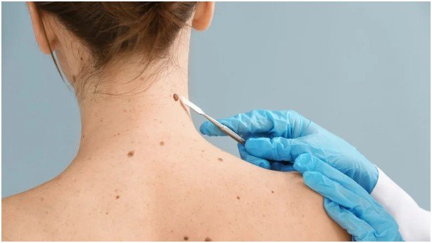 Accessing Skin Check Services in Melbourne